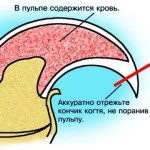 Строение когтя собаки.